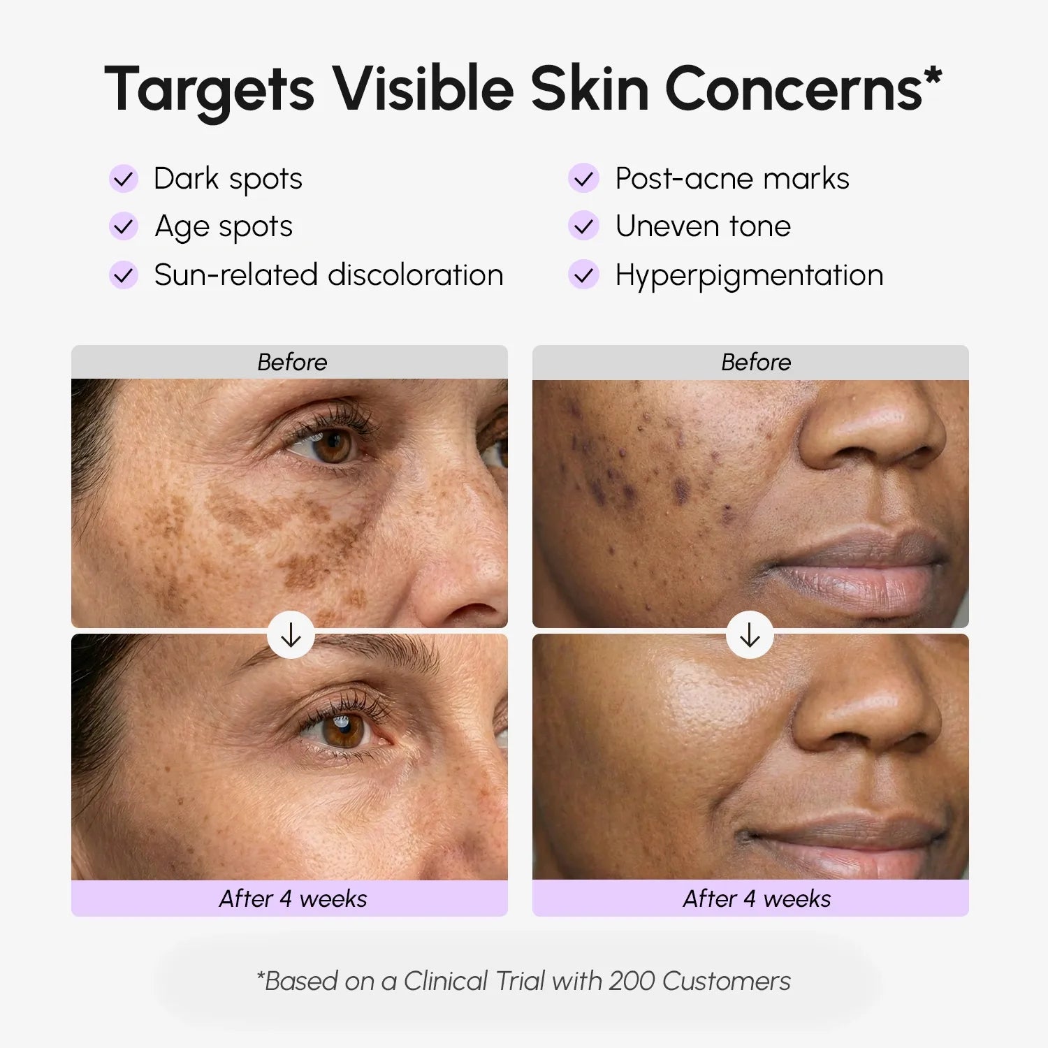 Sérum facial y corporal para manchas oscuras